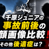 千原ジュニアの事故前後の顔画像比較！その他後遺症は？